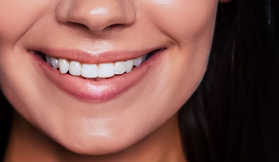 Myofunctional Therapy TC Dental Partners